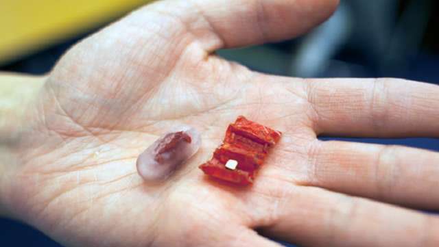Tiny ingestible robot could work wonders inside you - VIDEO